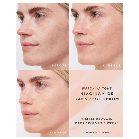 Fenty Skin Watch Ya Tone Niacinamide Dark Spot Serum, 1 oz Cruelty-Free Vegan - Picture 9 of 12